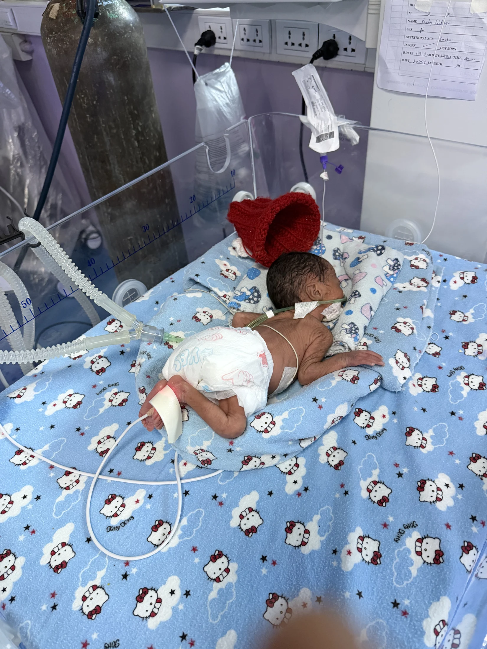 A newborn resting at a neonatal care station