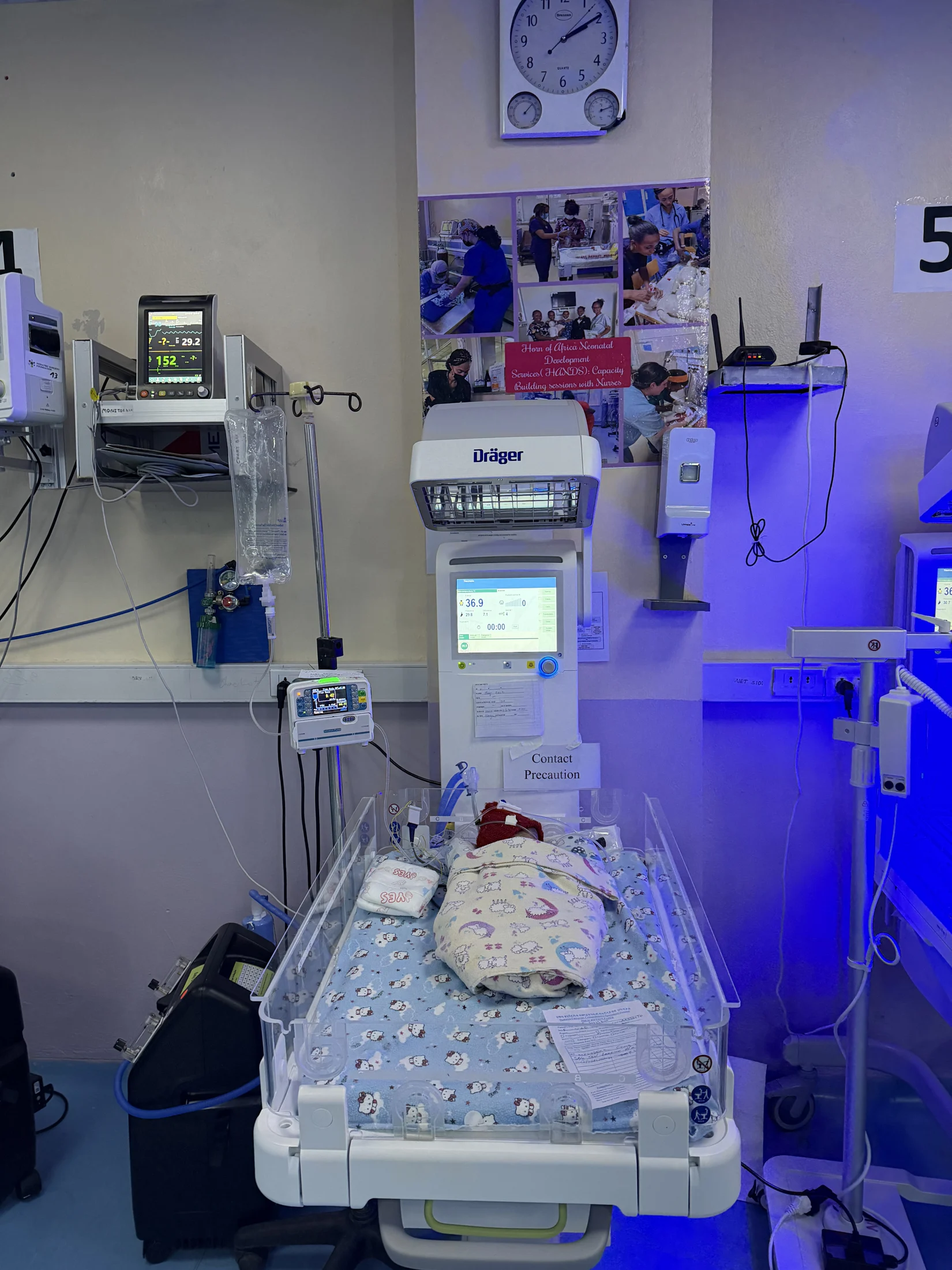 A neonatal care station with monitoring and phototherapy equipment