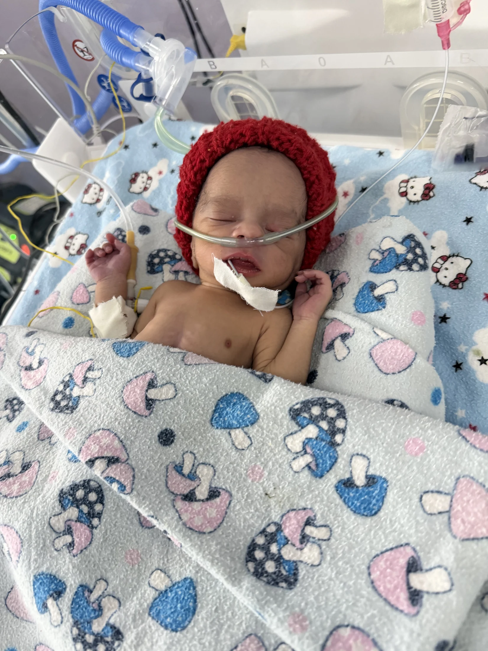 A newborn in a red knitted hat receiving care in Hawassa in 2026